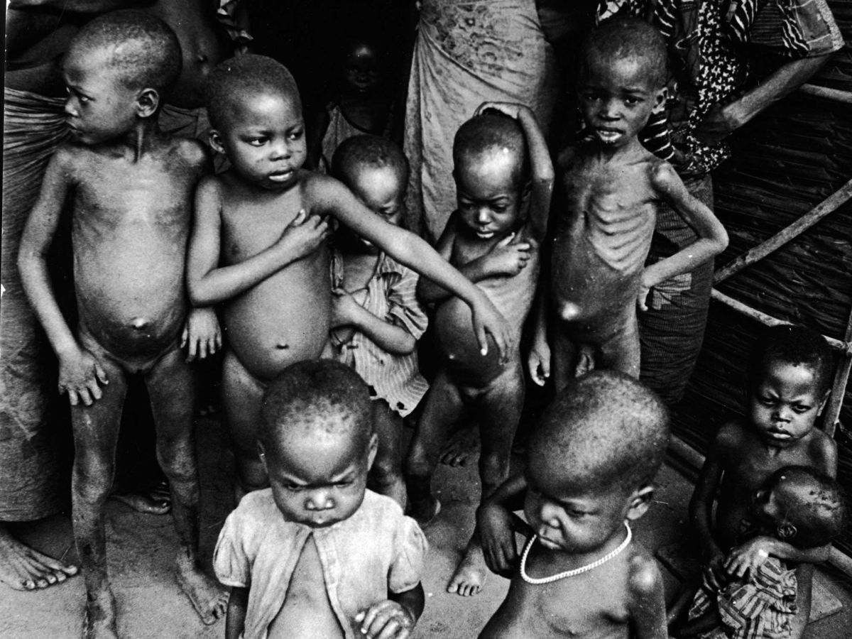 starving african people